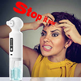 Blackhead Cleaner Vacuum Pore Cleaner Electric Blackhead Remover USB - White - Size 001 In Australia - Darrahopens