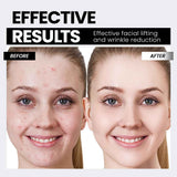 Microcurrent Facial Device,Latest Red Light Technology，Enhances The Ability to Lift The Face and Tighten The Skin，Facial Wrinkle Equipment，Smart Photon Micro-Current Device - White - Size 15cm In Australia - Darrahopens