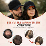 Laser Hair Growth Cap - 650nm Red Light Therapy for Hair Regrowth, Full Scalp Coverage Treatment for Men & Women with Thinning Hair, Portable & Hands-Free, Black In Australia - Darrahopens