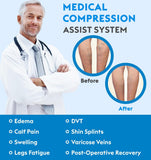 Compression socks, knee length, exposed toes, used for deep vein thrombosis, varicose veins, relief of tibial fractures, edema