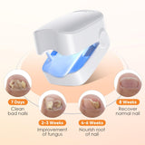 Nail fungus cleaning lamp device, household high-efficiency rechargeable nail fungus remover nail phototherapy lamp