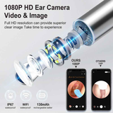 8-Piece Smart Visual Ear Cleaner, 1080P HD AI Warning, IP67 Waterproof Silicone Soft Tip, Safe and Comfortable Comfortable(black)