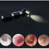 Mini Ear Otoscope, Magnification Diagnostic Inspection Ear Scope with LED Direct Illumination Ear Healthy Tool for Doctors Nurse Children In Australia - Darrahopens