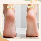 3PCS Precision Callus Remover & Bunion Scrubber for Toe Gaps, 2 Style Toe Callus Remover & Foot File Exfoliator with Compact Design for Pedicures and Sensitive Areas