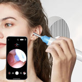 2pcs Ear Wax Removal Visual Ear Cleaner Tool Kit Ear Cleaning Scope Set-White