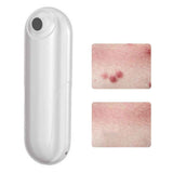 Bug Bite Itch Relief Tool USB Rechargeable Mosquito Bite Sucker Chemical Free for Bug Bites Bee Wasp Stings In Australia - Darrahopens