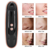 Blackhead Acnes Removal Machine Multifunction Visual Face Cleaner Device USB Charging