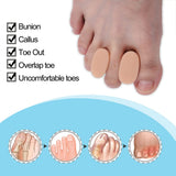 Gel Toe Separators,8 Pairs Toe Spacers To Straighten Overlapping Toes Toes Separator Soft Silicone Relieve Pain Reduce Friction