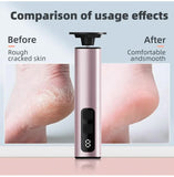 Purple Rechargeable Electric Foot File with 9 Speed Settings - Callus Remover for Smooth Feet