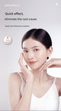Professional 9-Level Skin Tag & Spot Remover Pen - USB Rechargeable Beauty Device(Silver)