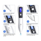 Professional 9-Level Skin Tag & Mole Remover Pen - USB Rechargeable with LED Display & Multiple Needles(Silver)