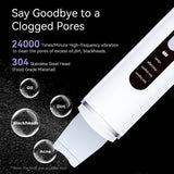 Rechargeable Ultrasonic Facial Spatula - Deep Pore Cleanser & Exfoliator