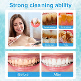 Ultrasonic Dental Scaler Kit - Home Use Teeth Cleaner & Tartar Remover