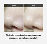 MEDICUBE Zero Foam Cleanser 120g – Deep Cleansing, Pore Care – AU Seller