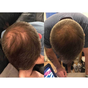 Darrahopens Health & Beauty > Hair Care Watermans Grow Me Hair Growth Shampoo 250ml DHT Blocking Biotin Argan Anti Loss