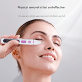 Darrahopens Health & Beauty > Health & Wellbeing > Wellness Accessories Professional Electric Mole & Dark Spot Remover Pen - Advanced Plasma Ion Technology for Seamless Skin Tag & Freckle Removal (Gold)