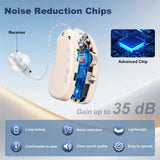 Darrahopens Health & Beauty > Health & Wellbeing > Wellness Accessories Rechargeable Hearing Amplifier with Charging Case – Compact Sound Enhancer for Daily Use, Noise Reduction & Clear Audio (White & Transparent Case, Skin Tone)