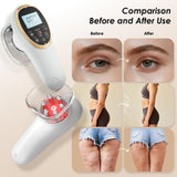 Darrahopens Health & Beauty > Massage & Relaxation > Massagers Modern Jingluo Beauty Massager – Electric Meridian Facial & Body Roller with Gentle Suction and Warmth, Multi-Speed Skincare Tool for Relaxing Rituals (White)