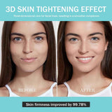 Darrahopens Health & Beauty > Massage & Relaxation > Massagers Upgraded Version | Skin Care Device - Facial Glow Booster for Maximizing and Boosting Absorption - Needle Free, Radiance, Elasticity | LED Anti-Wrinkle Device | Skin Care Firming, Toning In Australia - Darrahopens