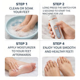 Darrahopens Health & Beauty > Personal Care > Foot Care Electric Foot Callus Remover | USB Rechargeable
