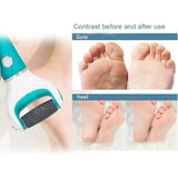 Darrahopens Health & Beauty > Personal Care > Foot Care Scholl Velvet Smooth Pedi Replacement Rollers 9-Pack, Compatible with Scholl