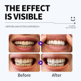 Darrahopens Health & Beauty > Personal Care > Oral Care Professional Enamel-Safe Teeth Whitening Strips(12 Strips per Pack) - Antibacterial Gum Care & Deep Cleaning