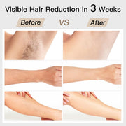 Darrahopens Health & Beauty > Shaving & Hair Removal > Hair Removal Laser Hair Removal, BoSidin IPL Hair Removal with Painless Ice-Cooling, 2-in-1 Face SR Rejuvenation, 6+1 Modes, 6 Levels Hair Removal for Women Permanent, Laser Hair Removal Kit with Shaver, Goggles
