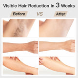 Darrahopens Health & Beauty > Shaving & Hair Removal > Hair Removal Laser Hair Removal, BoSidin IPL Hair Removal with Painless Ice-Cooling, 2-in-1 Face SR Rejuvenation, 6+1 Modes, 6 Levels Hair Removal for Women Permanent, Laser Hair Removal Kit with Shaver, Goggles