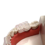Darrahopens Tools > Industrial Tools > Work Safety Protective Equipment 2pcs Anti Snore Mouth Guard Sleep Mouthguard Teeth Grinding Guard Dental Clenching Protector