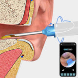 Darrahopens Tools > Industrial Tools > Work Safety Protective Equipment 2pcs Ear Wax Removal Visual Ear Cleaner Tool Kit Ear Cleaning Scope Set-White