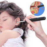 Wi -Fi visible wax elimination spoon, USB 1080P HD load otoscope