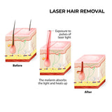 darrahopens Health & Beauty > Personal Care Silhouette Portable Laser Hair Remover Permanent Epliation System Body Face Home