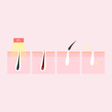 darrahopens Health & Beauty > Personal Care Silhouette Portable Laser Hair Remover Permanent Epliation System Body Face Home